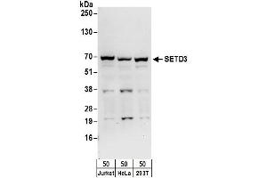 anti-SET Domain Containing 3 (SETD3) (AA 544-594) antibody
