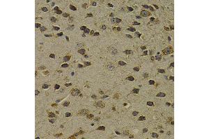 Immunohistochemistry (IHC) image for anti-8-Oxoguanine DNA Glycosylase (OGG1) (AA 1-345) antibody (ABIN3021937) (OGG1 抗体  (AA 1-345))
