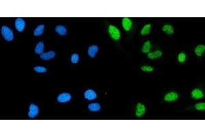 IF analysis of POLA1 using anti-POLA1 antibody (ABIN7601759). (POLA1 抗体  (AA 45-1429))