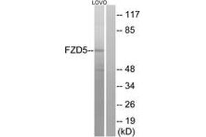 Western blot analysis of extracts from LOVO cells, using FZD5 Antibody. (FZD5 抗体  (AA 461-510))