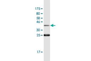 Western Blot detection against Immunogen (36. (SSH1 抗体  (AA 950-1049))