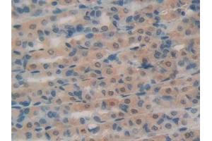 DAB staining on IHC-P; Samples: Rat Intestine Tissue (RNASE1 抗体  (AA 26-152))