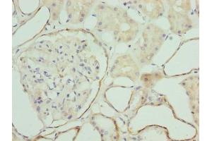 Immunohistochemistry of paraffin-embedded human kidney tissue using ABIN7176389 at dilution of 1:100 (ZNF563 抗体  (AA 214-476))