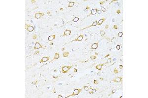 Immunohistochemistry of paraffin-embedded rat brain using HSPA5 antibody (ABIN5997936) at dilution of 1/100 (40x lens). (GRP78 抗体)