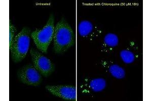 Fluorescent image of U251 cells stained with anti-ATG5 antibody diluted at 1:25 dilution. (ATG5 抗体  (AA 209-238))