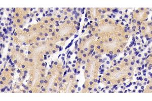 Detection of IFNa in Mouse Kidney Tissue using Polyclonal Antibody to Interferon Alpha (IFNa) (IFNA 抗体  (AA 24-189))