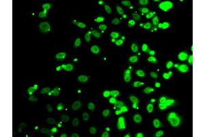 Immunofluorescence analysis of A549 cells using FIP1L1 antibody. (FIP1L1 抗体)