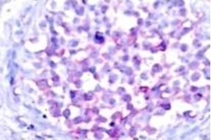 Image no. 2 for anti-V-Raf-1 Murine Leukemia Viral Oncogene Homolog 1 (RAF1) (pSer259) antibody (ABIN318109) (RAF1 抗体  (pSer259))