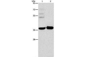 Western Blot analysis of A172 cell and Human fetal brain tissue using SERPINE2 Polyclonal Antibody at dilution of 1:450 (SERPINE2 抗体)