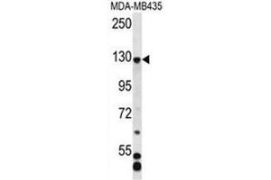 C7orf63 Antibody (N-term) western blot analysis in MDA-MB435 cell line lysates (35µg/lane). (C7orf63 抗体  (N-Term))
