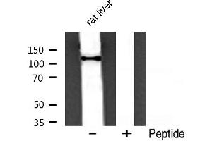Western blot analysis of PI3 kinase P110α expression in rat liver (PIK3CA 抗体  (Internal Region))