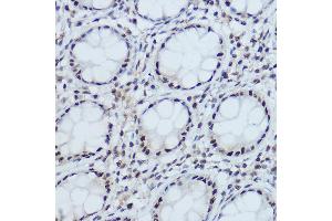 Immunohistochemistry of paraffin-embedded human colon using DDB1 Rabbit pAb (ABIN1679509, ABIN5664466, ABIN5664468 and ABIN6220382) at dilution of 1:350 (40x lens). (DDB1 抗体  (C-Term))