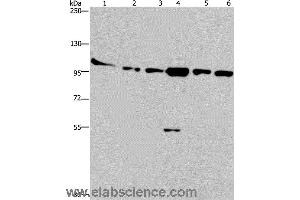 Western blot analysis of Human testis tissue, K562, A549, Raji, NIH/3T3 and Hela cell, using PRKD3 Polyclonal Antibody at dilution of 1:200 (PRKD3 抗体)