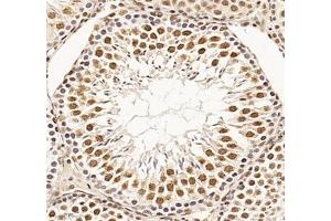 Immunohistochemistry of paraffin embedded rat testis using RBM8A (ABIN7075478) at dilution of 1: 300 (300x lens)