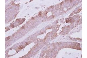 Image no. 1 for anti-Na Pump alpha Subunit (ATPALPHA) (Internal Region) antibody (ABIN1493677) (Atpalpha 抗体  (Internal Region))