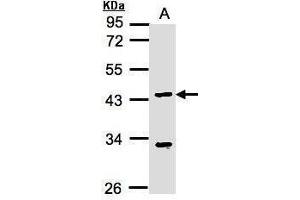 WB Image Sample(30 ug whole cell lysate) A:MOLT4 , 10% SDS PAGE antibody diluted at 1:1000 (KLF15 抗体  (N-Term))