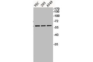 Western Blot analysis of VEC 293 A549 cells using BMP-5 Polyclonal Antibody (BMP5 抗体  (Internal Region))