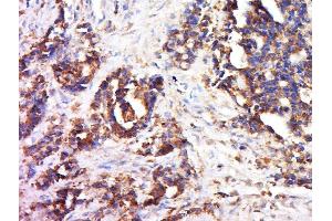 Immunohistochemistry (Paraffin-embedded Sections) (IHC (p)) image for anti-Collagen, Type III (COL3) (AA 801-900) antibody (ABIN730168)