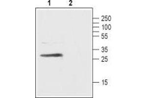 Western blot analysis of rat pancreas lysate:  - 1. (FFAR1 抗体  (3rd Extracellular Loop))