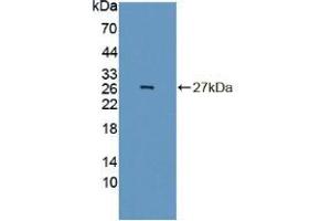 Western blot analysis of recombinant Mouse INSM1. (INSM1 抗体  (AA 278-518))