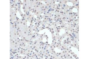 Immunohistochemistry of paraffin-embedded Mouse kidney using Phospho-Jak2(Y1007/1008) Polyclonal Antibody at dilution of 1:200 (40x lens). (JAK2 抗体  (pTyr1007, pTyr1008))