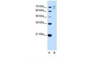 Image no. 2 for anti-Ring Finger Protein 168 (RNF168) (AA 401-450) antibody (ABIN6739167) (RNF168 抗体  (AA 401-450))
