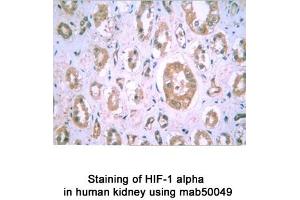 Image no. 2 for anti-Hypoxia Inducible Factor 1, alpha Subunit (Basic Helix-Loop-Helix Transcription Factor) (HIF1A) (AA 432-528) antibody (ABIN363203)