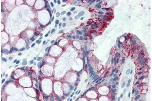 Human Colon (formalin-fixed, paraffin-embedded) stained with CLDN4 antibody ABIN334265 at 5 ug/ml followed by biotinylated anti-mouse IgG secondary antibody ABIN481714, alkaline phosphatase-streptavidin and chromogen. (Claudin 4 抗体  (C-Term))