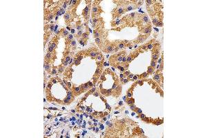 Immunohistochemical analysis of paraffin-embedded H. (CAPNL1 抗体  (AA 1-420))