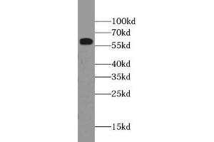 WB analysis of HEK293T cells subjected to SDS-PAGE, using RBM39 antibody (1/500 dilution). (RBM39 抗体)