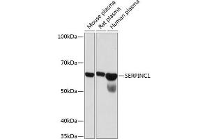 Western blot analysis of extracts of various cell lines, using SERPINC1 Rabbit mAb (ABIN7270208) at 1:1000 dilution. (SERPINC1 抗体)