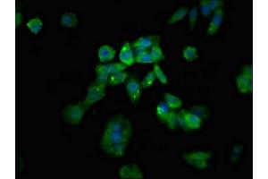 Immunofluorescent analysis of HepG2 cells using ABIN7167586 at dilution of 1:100 and Alexa Fluor 488-congugated AffiniPure Goat Anti-Rabbit IgG(H+L) (RGS1 抗体  (AA 14-209))