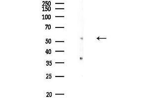 Western blot analysis of lysates from Rat testis, using Cytochrome P450 39 Antibody at 1/1000 dilution.
