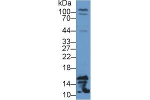 Detection of FABP4 in Rat Testis lysate using Polyclonal Antibody to Fatty Acid Binding Protein 4 (FABP4) (FABP4 抗体  (AA 2-132))