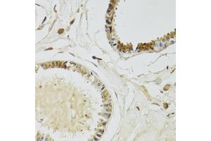 Immunohistochemistry of paraffin-embedded human breast using KLK10 Antibody (ABIN6142943) at dilution of 1:100 (40x lens). (Kallikrein 10 抗体  (AA 35-276))