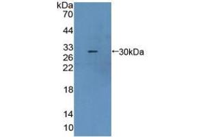 Western blot analysis of recombinant Mouse CBR1. (CBR1 抗体  (AA 66-271))