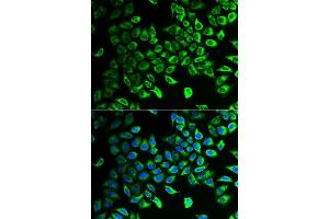 Immunofluorescence analysis of U2OS cells using DDAH2 antibody. (DDAH2 抗体  (AA 1-285))
