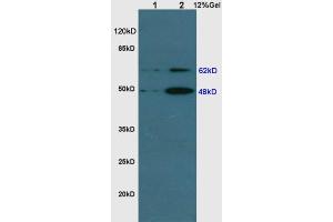 Western Blotting (WB) image for anti-Sequestosome 1 (SQSTM1) (AA 51-150) antibody (ABIN682153)