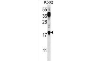 Western Blotting (WB) image for anti-Parathymosin (PTMS) antibody (ABIN2996966) (Parathymosin 抗体)