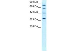 Western Blotting (WB) image for anti-Cyclin-Dependent Kinase 7 (CDK7) antibody (ABIN2463672) (CDK7 抗体)