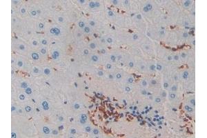 Detection of IL2 in Human Liver Tissue using Monoclonal Antibody to Interleukin 2 (IL2) (IL-2 抗体  (AA 21-153))