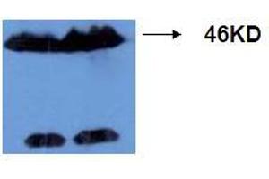 Western Blotting (WB) image for anti-Microtubule-Associated Protein tau (MAPT) (AA 177-187), (pThr181) antibody (ABIN1108155) (MAPT 抗体  (pThr181))