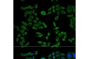 Immunofluorescence analysis of HeLa cells using VAPB Polyclonal Antibody (VAPB 抗体)