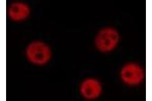 ABIN6276756 staining Hela by IF/ICC. (ERCC5 抗体  (N-Term))