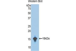 Western blot analysis of the recombinant protein. (Complement Factor B 抗体  (AA 476-592))