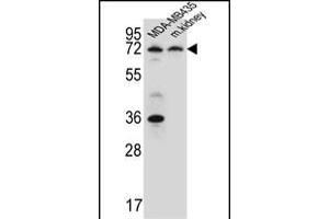 P2RX7 Antibody (C-term) (ABIN651861 and ABIN2840427) western blot analysis in MDA-M cell line and mouse kidney tissue lysates (15 μg/lane). (P2RX7 抗体  (AA 563-592))