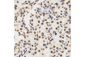 Immunohistochemistry (Paraffin-embedded Sections) (IHC (p)) image for anti-Histone 3 (H3) (H3K9me2) antibody (ABIN3023260)