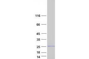 Western Blotting (WB) image for Family with Sequence Similarity 107, Member A (FAM107A) (Transcript Variant 1) protein (Myc-DYKDDDDK Tag) (ABIN2720725)