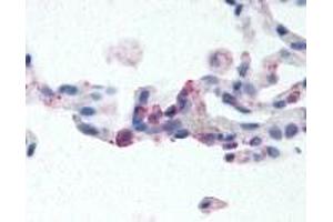 Immunohistochemistry (IHC) image for anti-Egf-Like Module Containing, Mucin-Like, Hormone Receptor-Like 2 (EMR2) (N-Term) antibody (ABIN2469427)