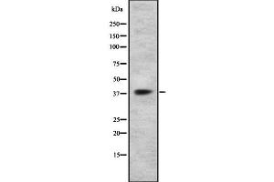 Western blot analysis GPR105 using HT29 whole cell lysates (P2RY14 抗体  (Internal Region))